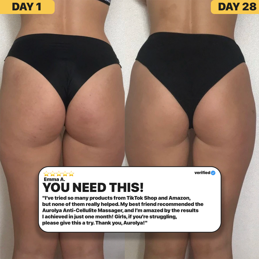 Aurolya™ Cellulite relief in 30 days