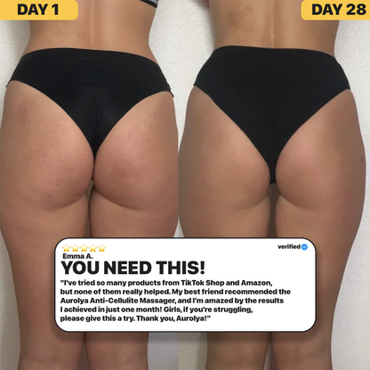 Aurolya™ Cellulite relief in 30 days